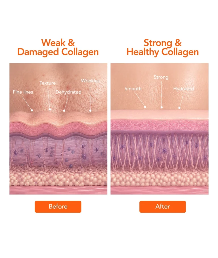 skin booster